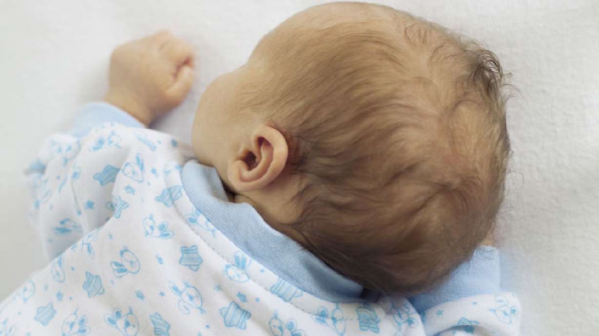 The flip side of infertility