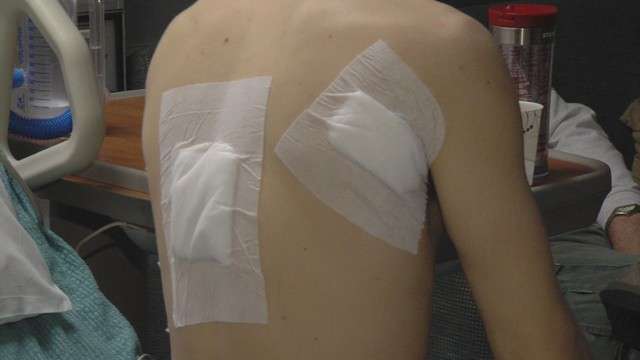 Alex Elsmore was stabbed in the back and below his right shoulder. One of the wounds is six inches deep and less than an inch from his heart.