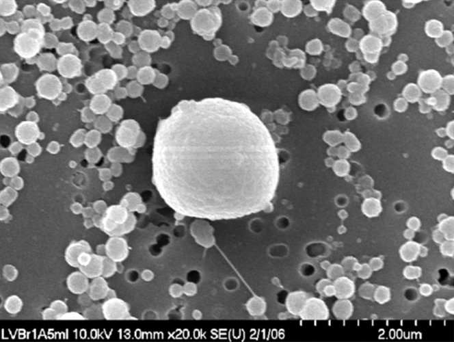 A scanning electron micrograph of a bacterium found in the the lake.