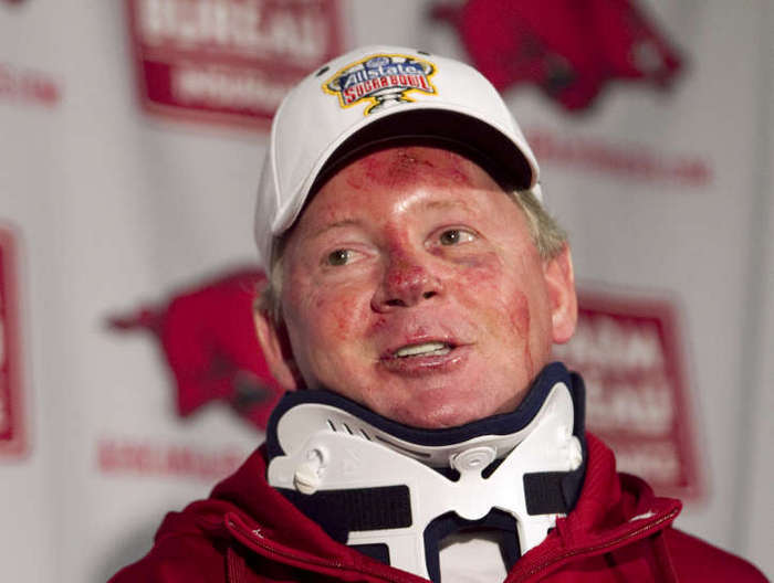 FILE -Former Arkansas football coach Bobby Petrino speaks during a news conference in Fayetteville, Ark., after being released from a hospital after he was injured in a motorcycle accident. (AP Photo/Gareth Patterson, File)