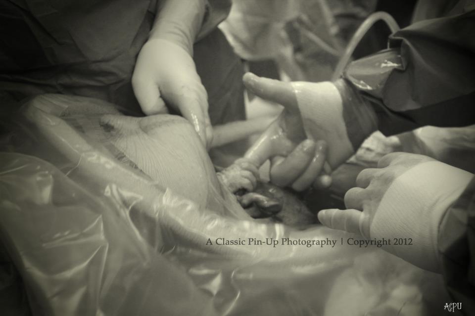 Photo shows baby reach out of womb, grasp doctor's finger