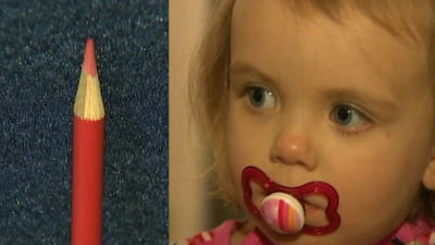 Little girl survives after pencil pierces eye, brain