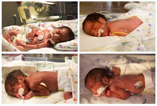 Tressa Montalvo delivered two sets of identical twin boys on Thursday, Feb. 14, 2013, Valentine's Day, at The Woman's Hospital of Texas in Houston. Montalvo delivered sons Ace, top left, and Blaine, top right, at 8:51 a.m. Sons Cash, bottom left, and Dylan arrived a minute later.