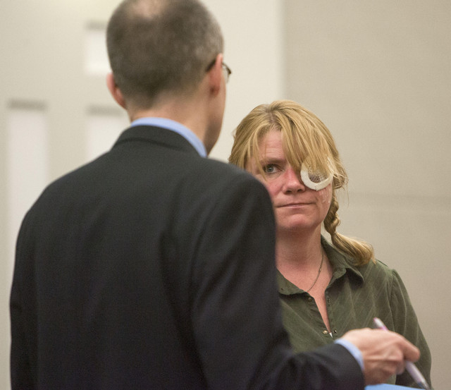 Woman shot in eye by police gets probation for leading chase