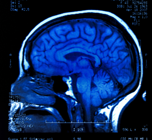 Brain scan may predict future crime, researchers say