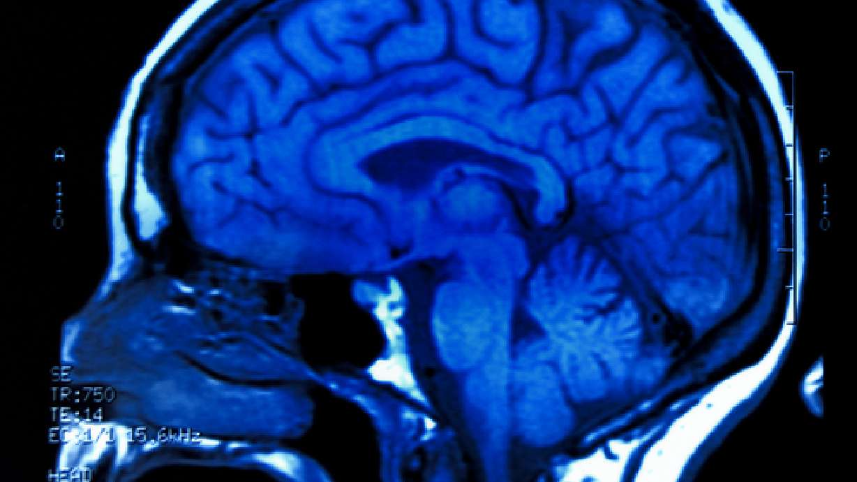 Brain scan may predict future crime, researchers say