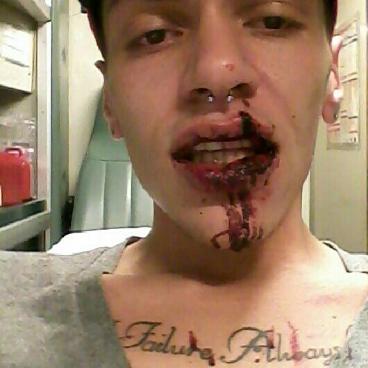A photo shows Cameron Judd shortly after he was allegedly assaulted.