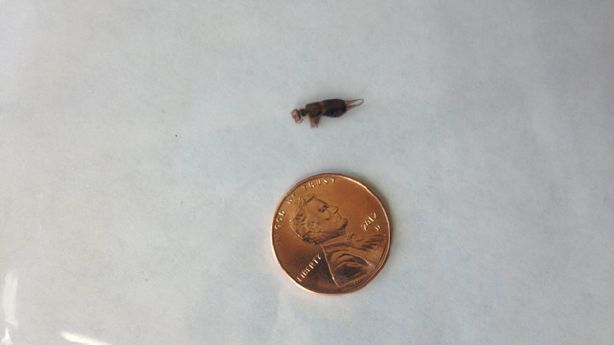 Earwig Makes Home In Sandy Man S Nose Dies There Ksl Com