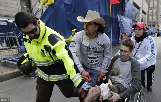Jeff Bauman being carried away from the scene of the explosion with his legs severed below the knee. Photo Credit: Associated Press