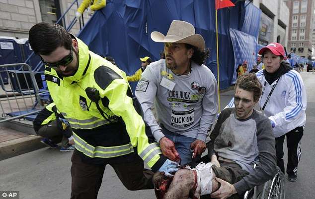 Jeff Bauman being carried away from the scene of the explosion with his legs severed below the knee. Photo Credit: Associated Press
