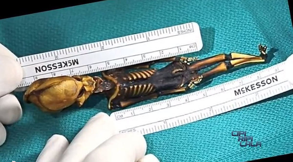 Tiny alien-like skeleton has human DNA