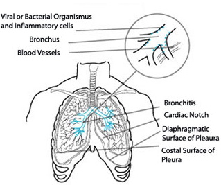 Should I Worry About Coughing Up Green Mucus Mucinex Usa Should I Worry About Coughing Up Green Mucus Mucinex Usa