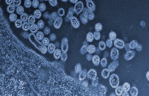 This undated handout image provided by Science and the University of Tokyo shows infectious particles of the avian H7N9 virus emerging from a cell. Another case of bird flu has been confirmed Thursday at a Logan zoo, officials said.