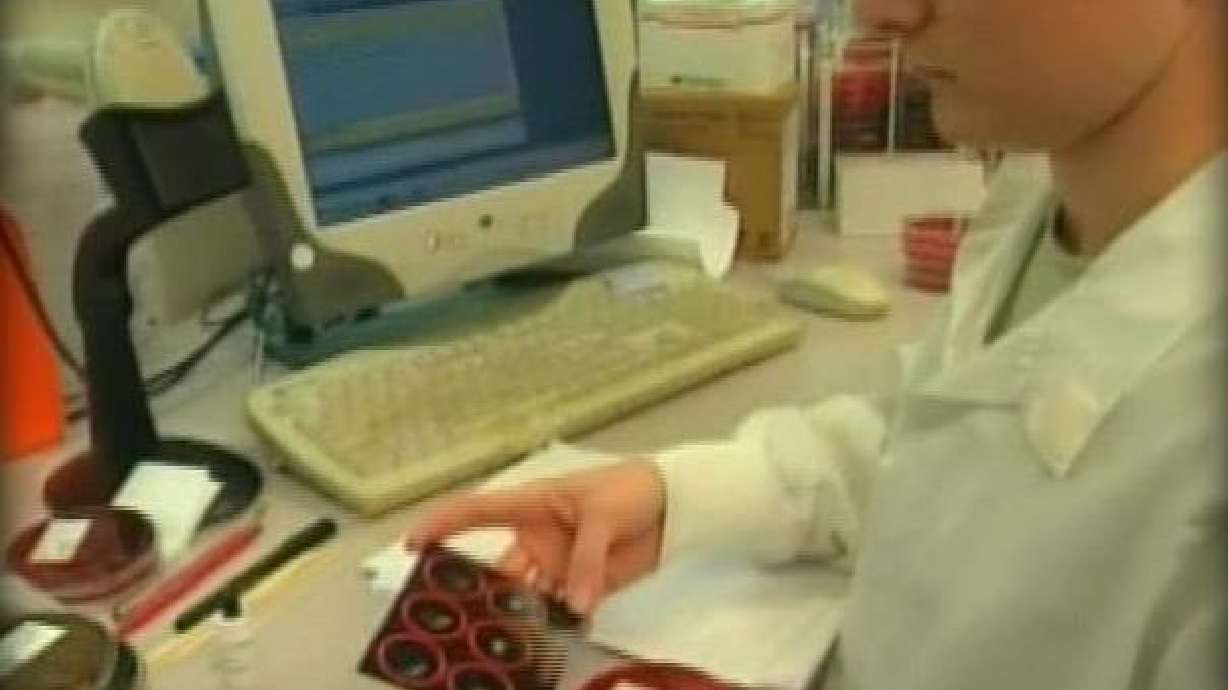 Doctor Says Staph Infections are No Reason To Panic