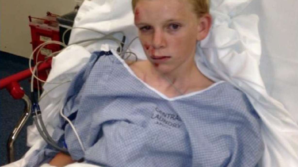 10-year-old boy hit by woman with DUI history