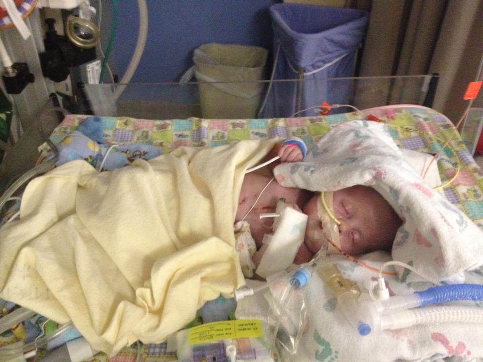 'Miracle' baby fights severe congenital disorder