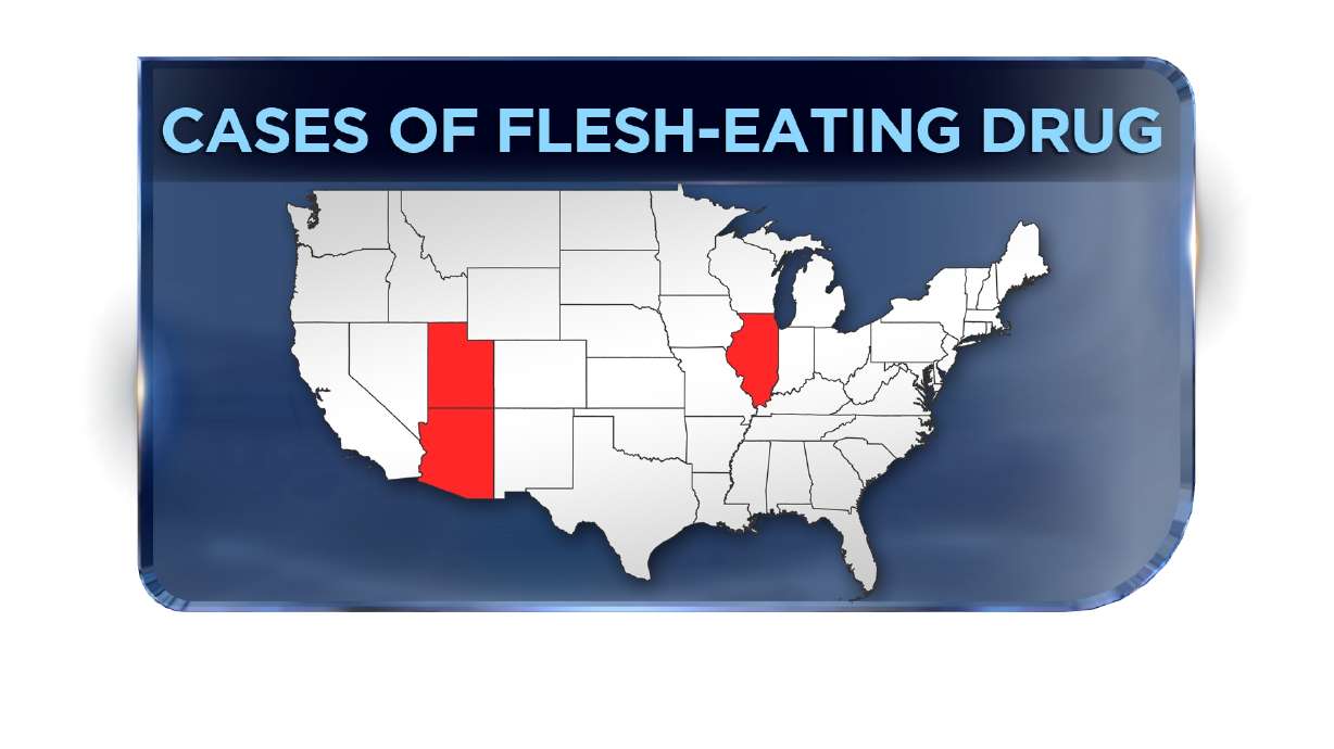 Flesh-eating 'zombie' drug 'kills you from the inside out'