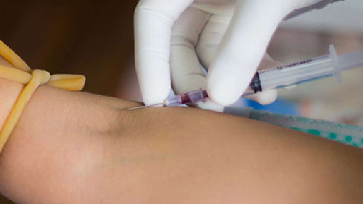 New blood test may predict life expectancy, researchers say