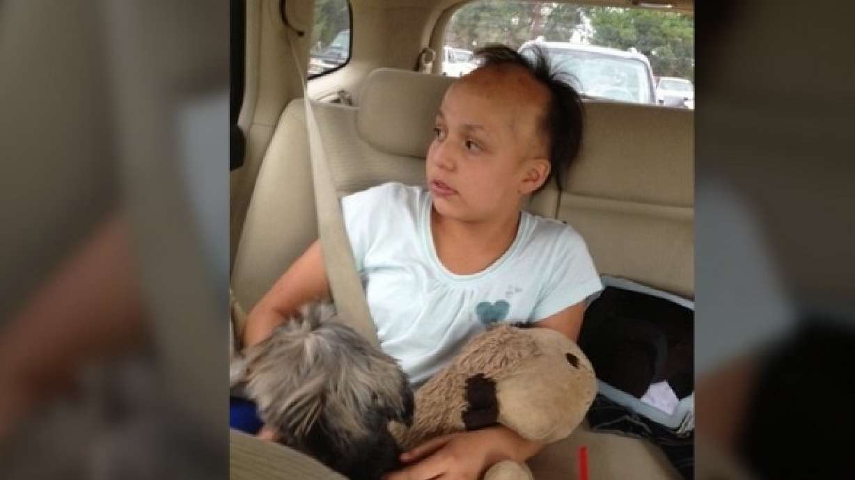 Brave middle schooler tells peers she's bald