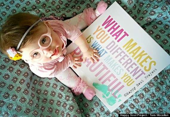 "Happy Soul Project is there to show others
that although our life, our daughter, is
different, our lives are brilliant all the
same." -mom Tara McCallan