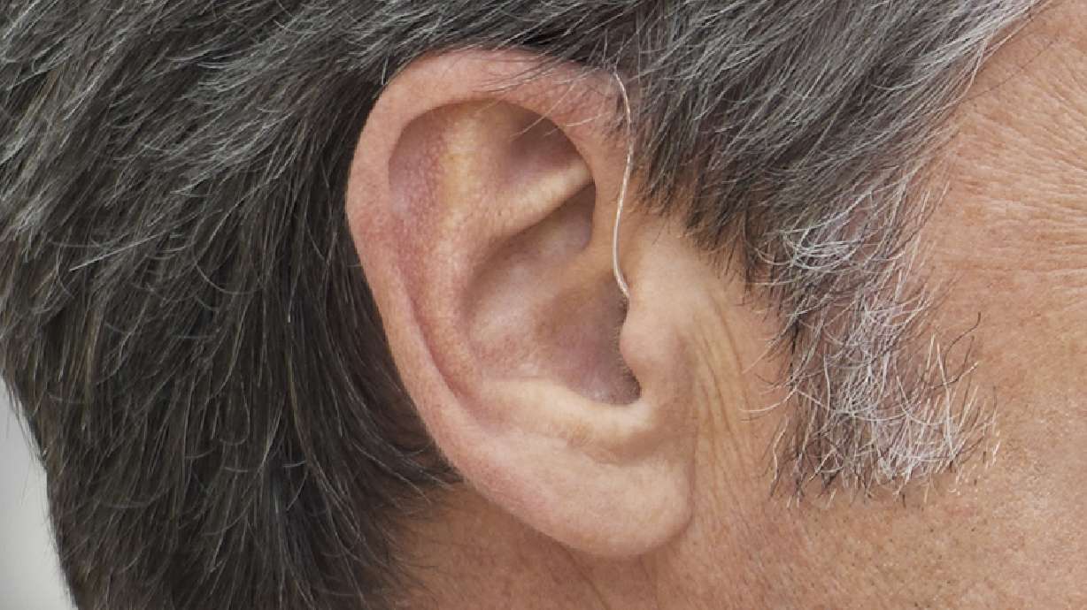Kate Johnson, an audiologist in the department of otolaryngology at University of Utah Health, said she is excited about hearing aids becoming a little more affordable and having them on visible shelves, which will help bring more awareness to hearing loss, but she voiced some concerns.
