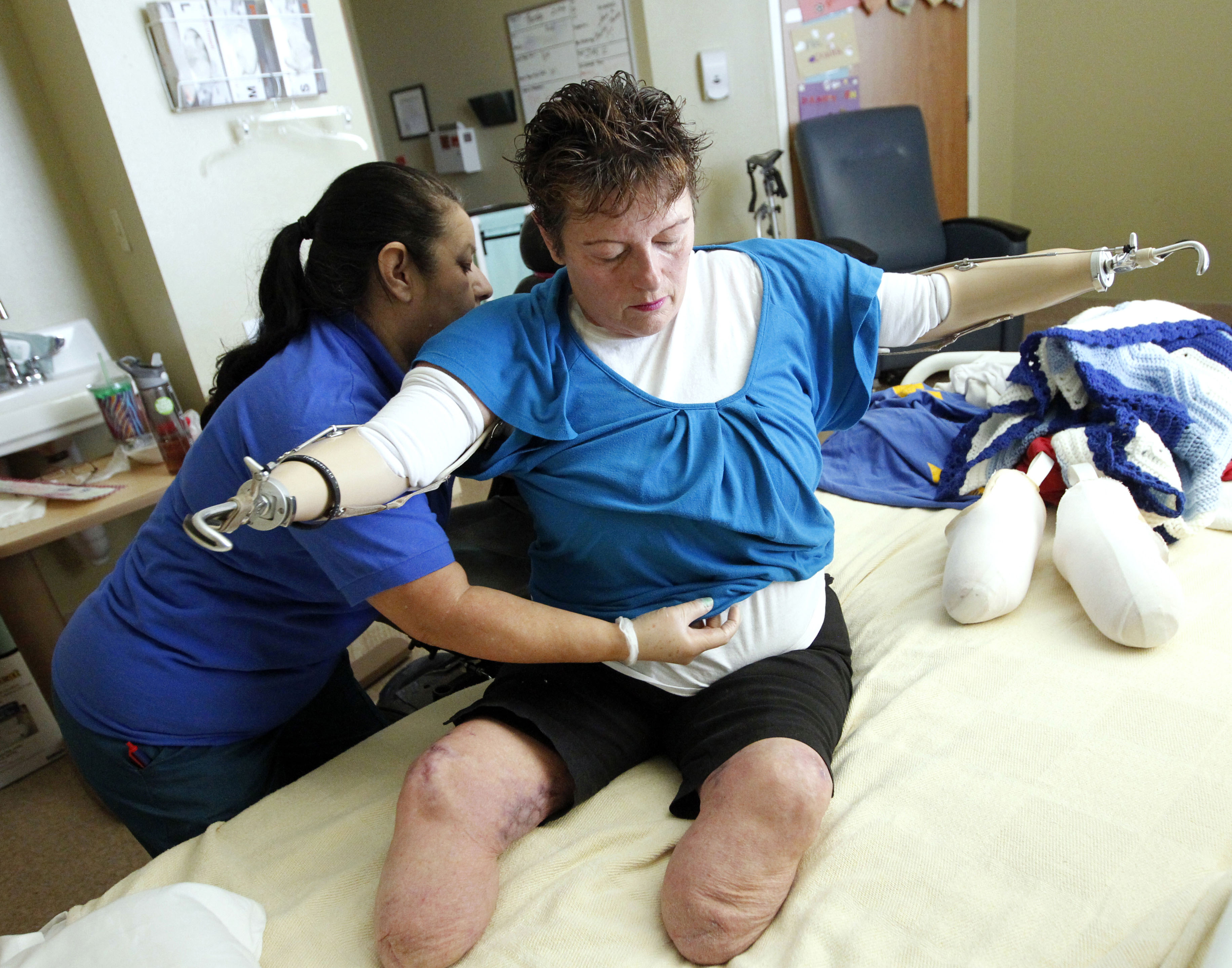 Infection costs woman her limbs but not her spirit