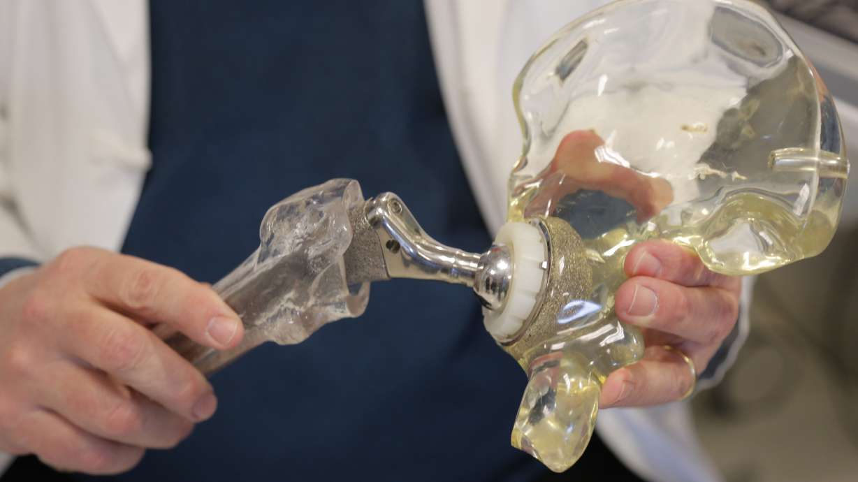 Study: 2 percent of Americans have new hips, knees