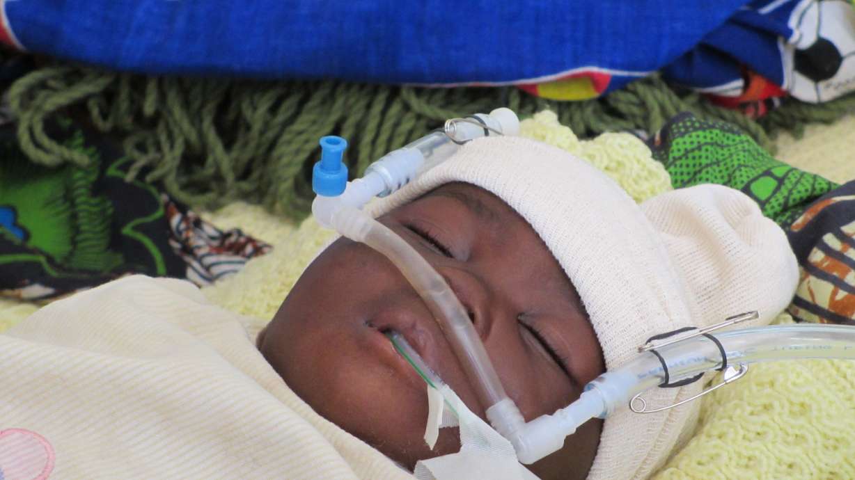 Aquarium pumps saving babies' lives