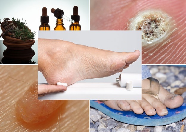 From essential oils to 'stinky feet': the 5 most popular 'Mommy Medicine' articles