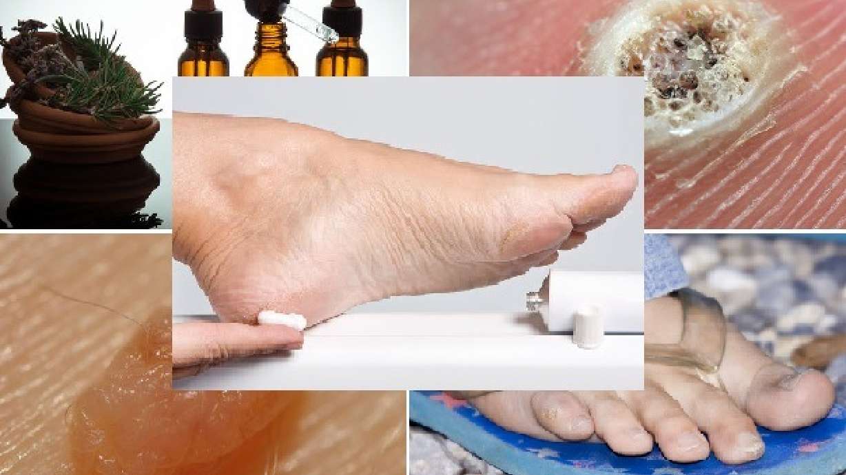 From essential oils to 'stinky feet': the 5 most popular 'Mommy Medicine' articles