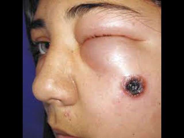 Mantén tu casa libre de arañas peligrosas