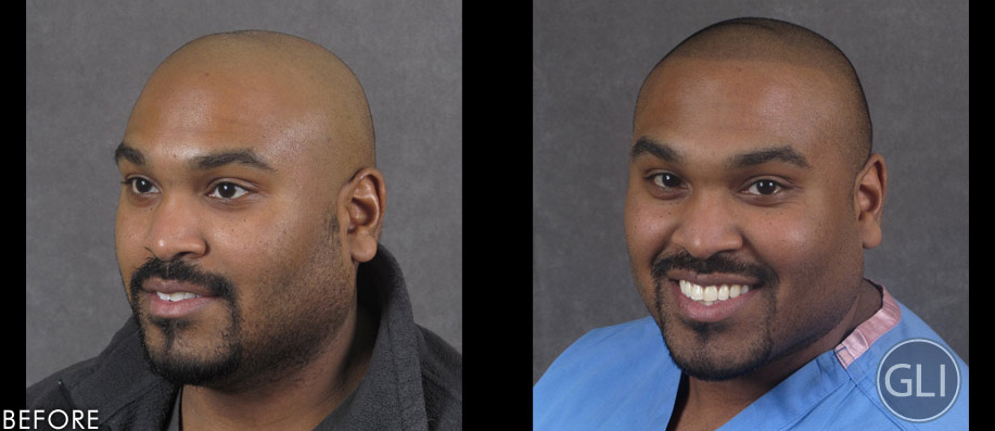 Clinic for Hair-Replacement Alternative Adds Medical Director; Demand Grows for Emerging Practice