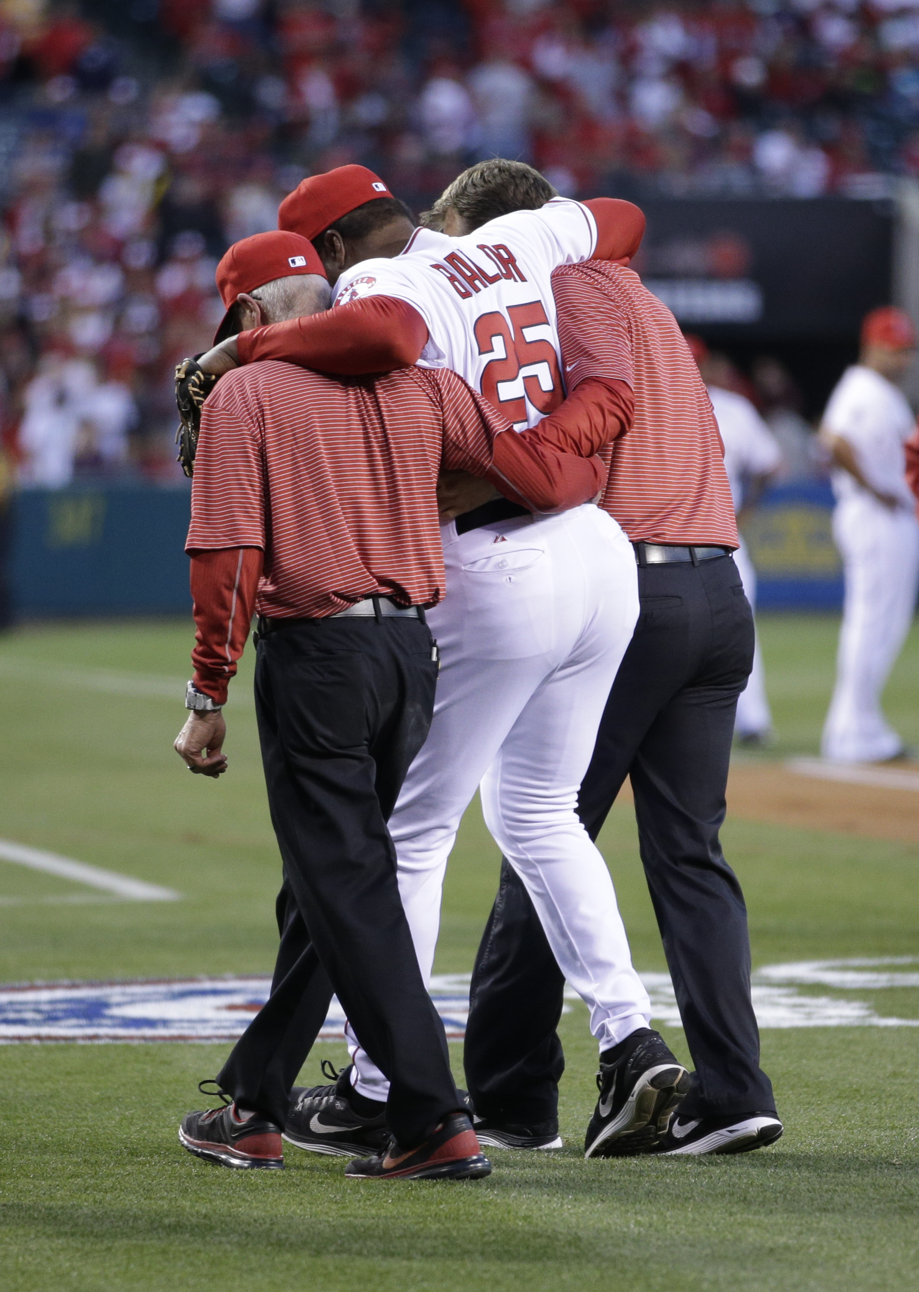 Angels coach Don Baylor has surgery on broken leg