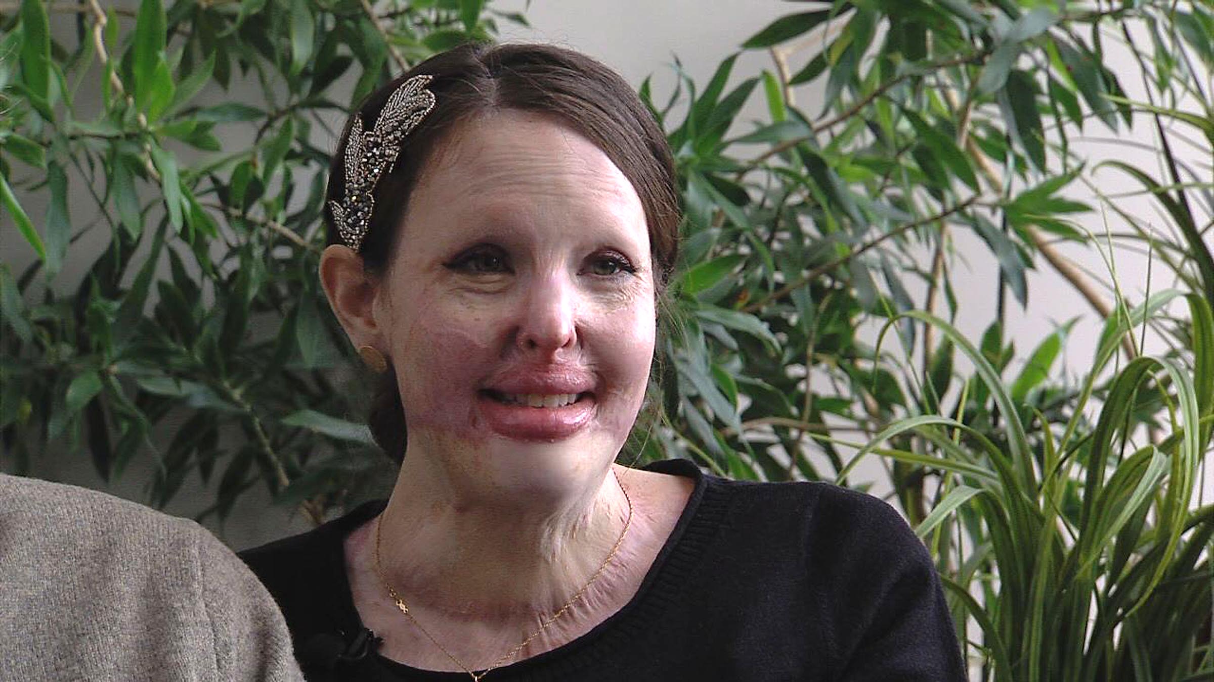 What Stephanie Nielson taught me about life