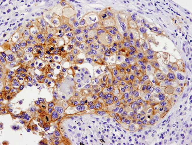Cell Signaling Technology, Inc. Announces PD-L1 Antibody, Important to Cancer Immunotherapy Research