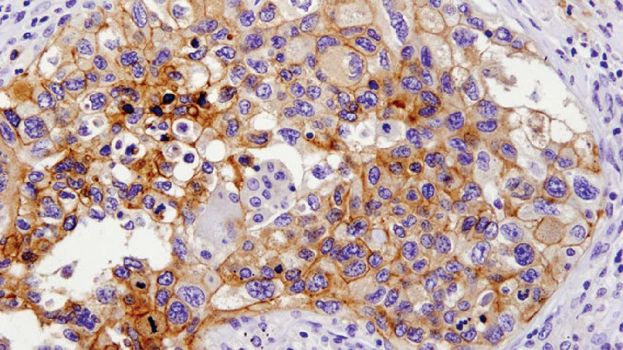 Cell Signaling Technology, Inc. Announces PD-L1 Antibody, Important to Cancer Immunotherapy Research