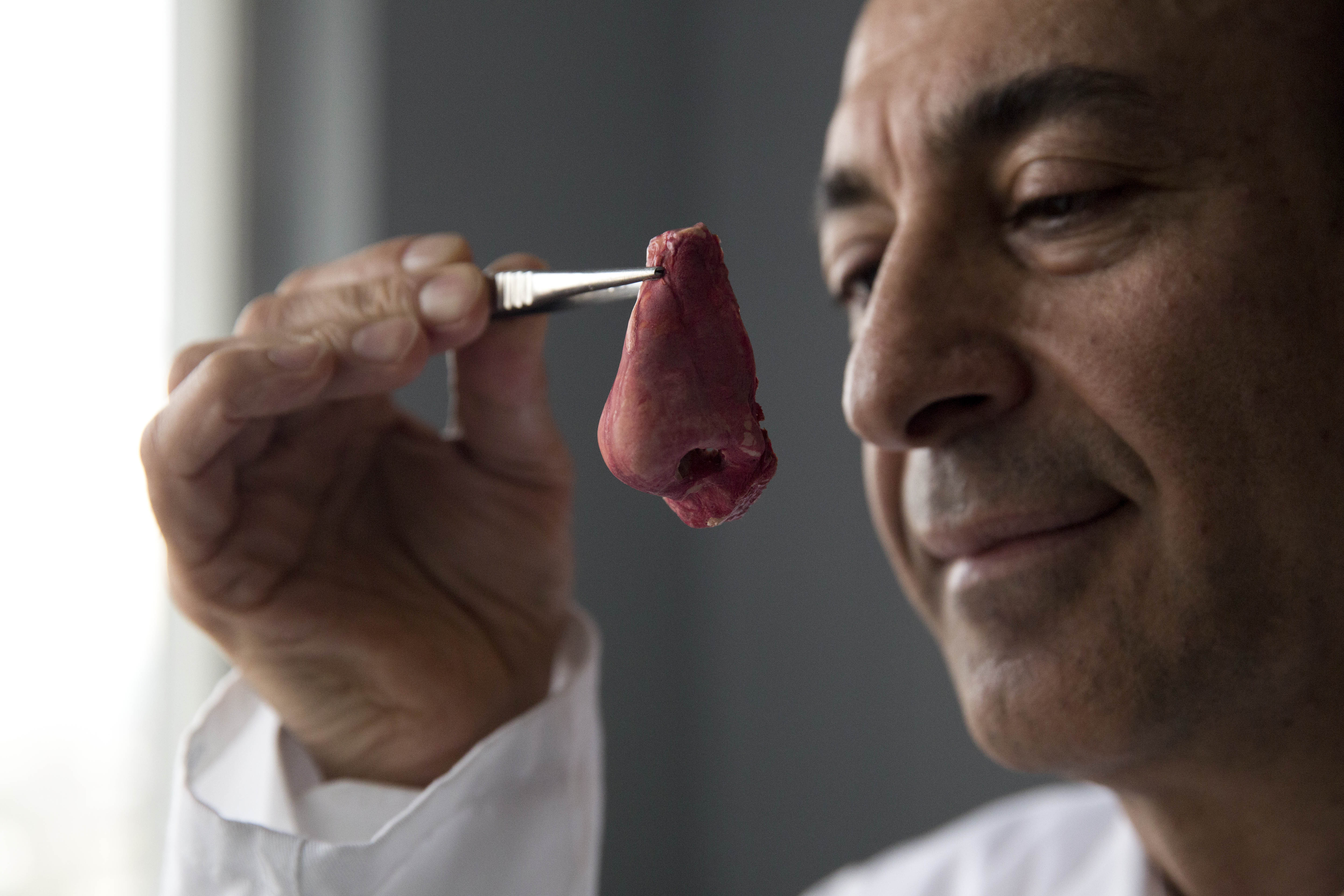 Noses, made in Britain: UK touts lab-grown organs
