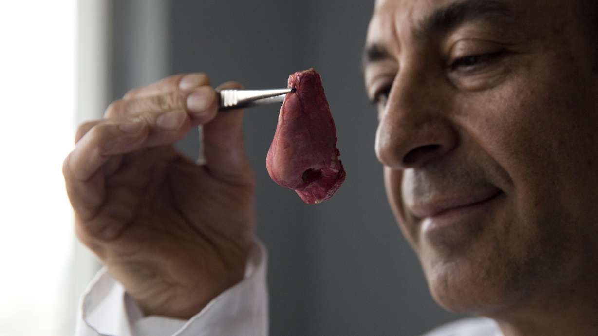 Noses, made in Britain: UK touts lab-grown organs