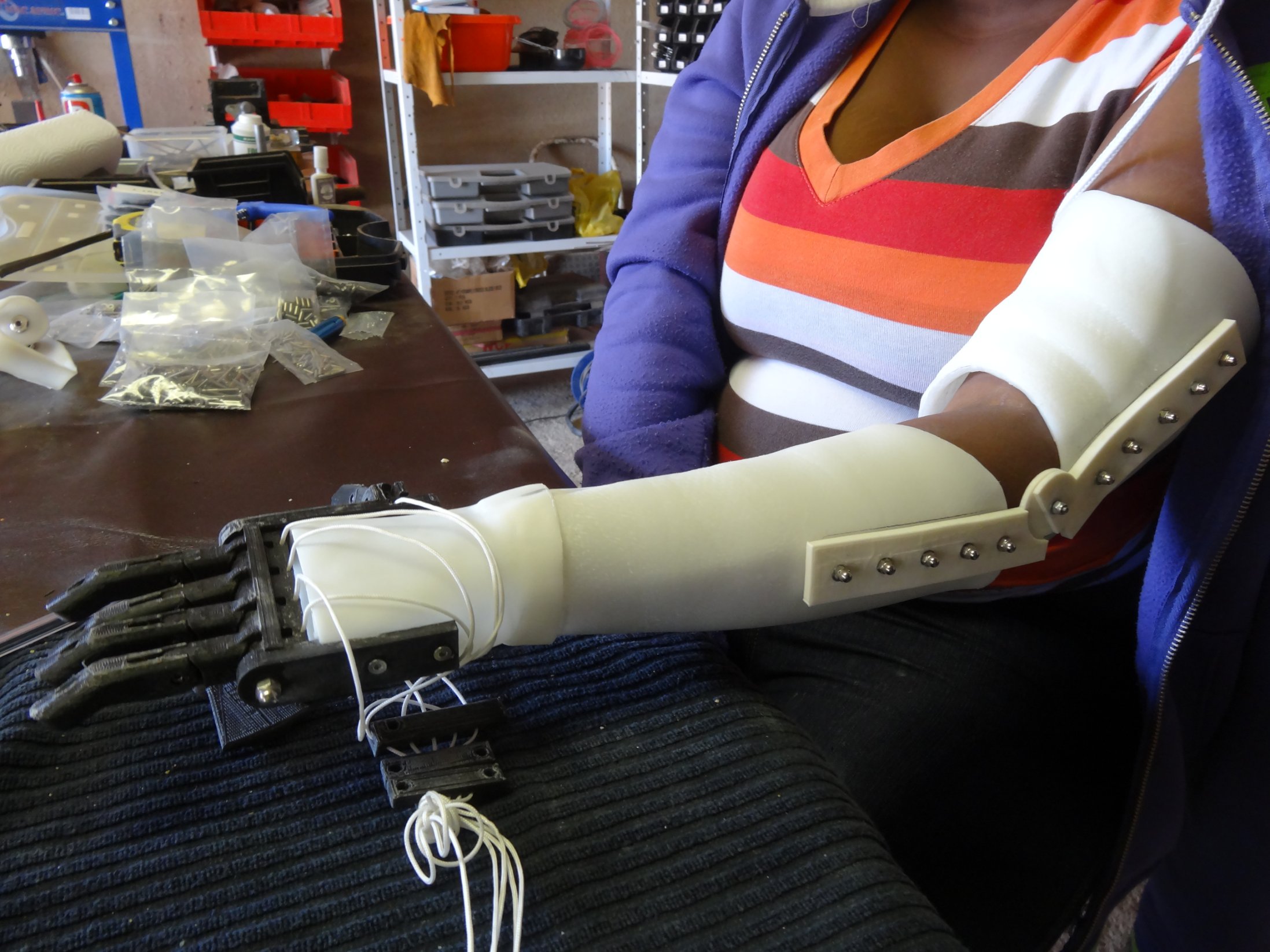 Carpenter who cut off his fingers makes 'Robohand' with 3-D printer