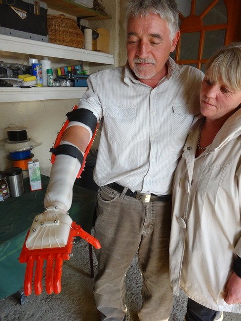 The prosthetics are anatomically driven — meaning their
movements are controlled by the user — and are much cheaper
than conventional devices. Credit: Courtesy Makerbot