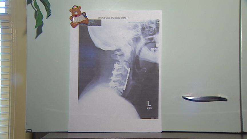 Utah MRSA Patient Speaks Out in Hopes of Helping Public