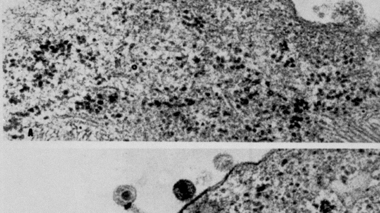 AP WAS THERE: Probable cause of AIDS found