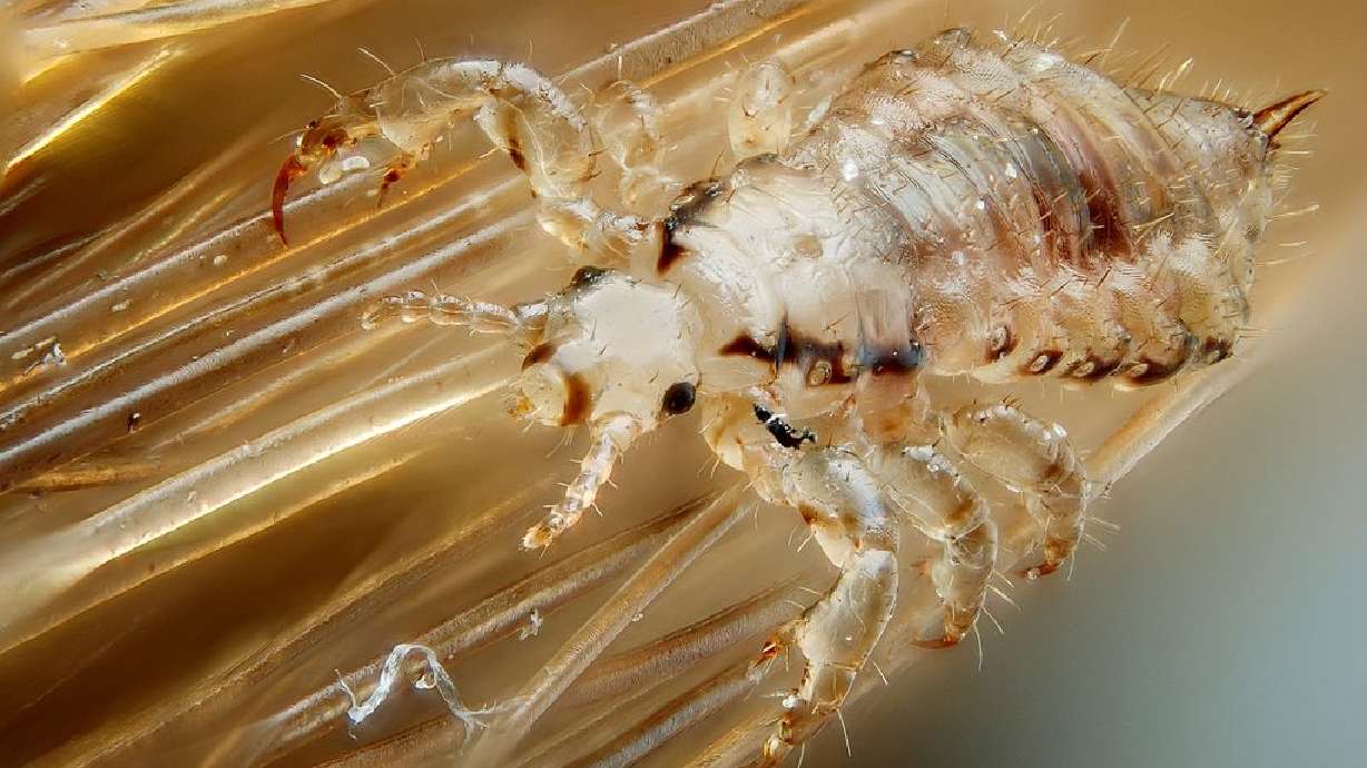 What to do about lice: treatment options and prevention tips | KSL.com
