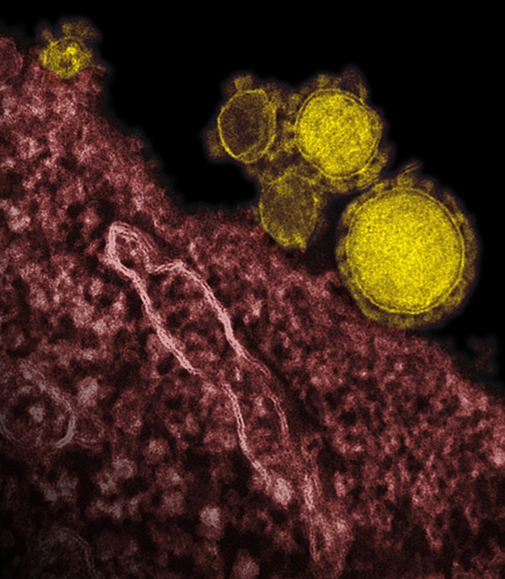 Saudi Arabia reports 5 new deaths from MERS