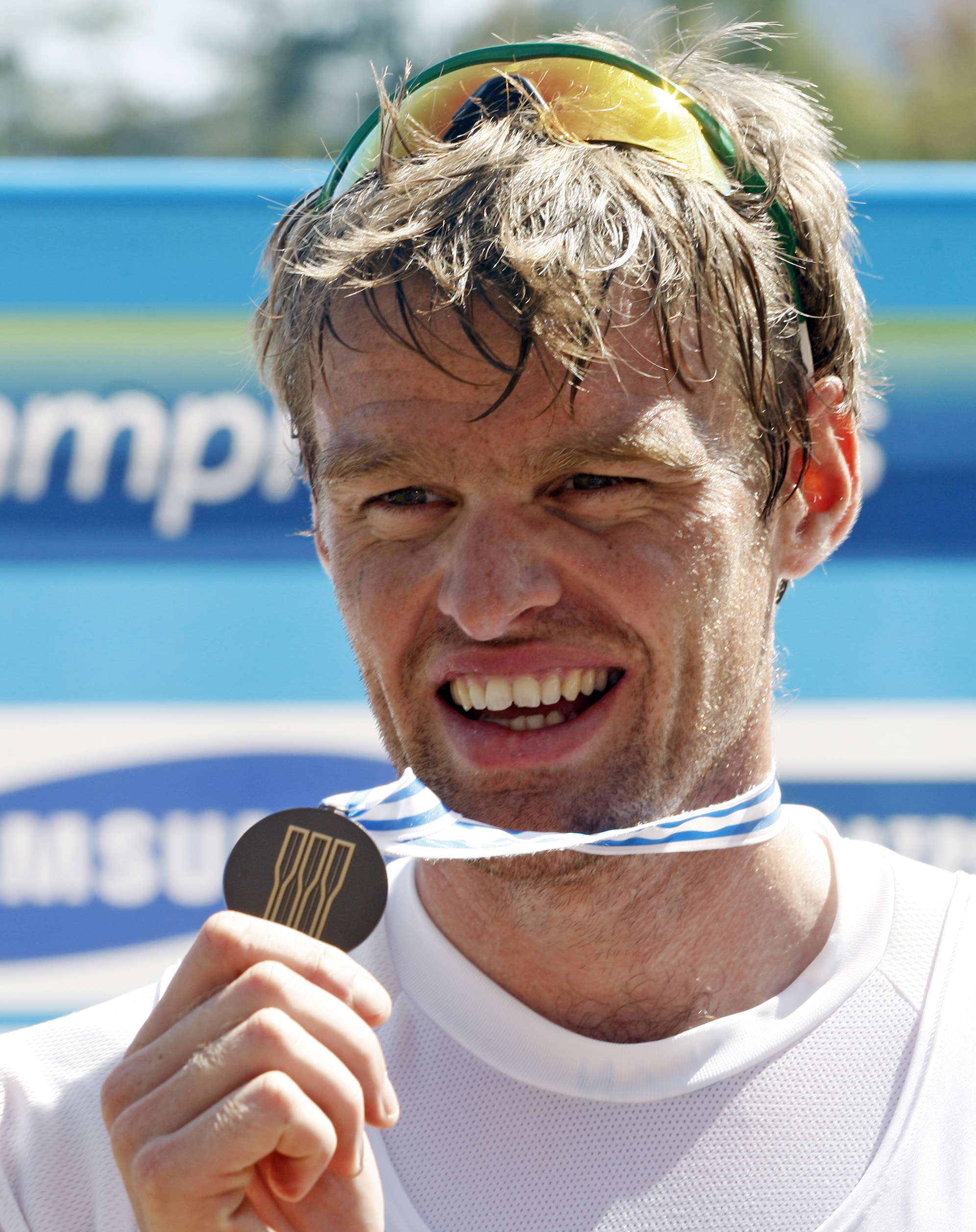 The paradox of Olympians' "garbage" teeth