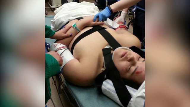 West Valley teen learns helmet safety rules the hard way