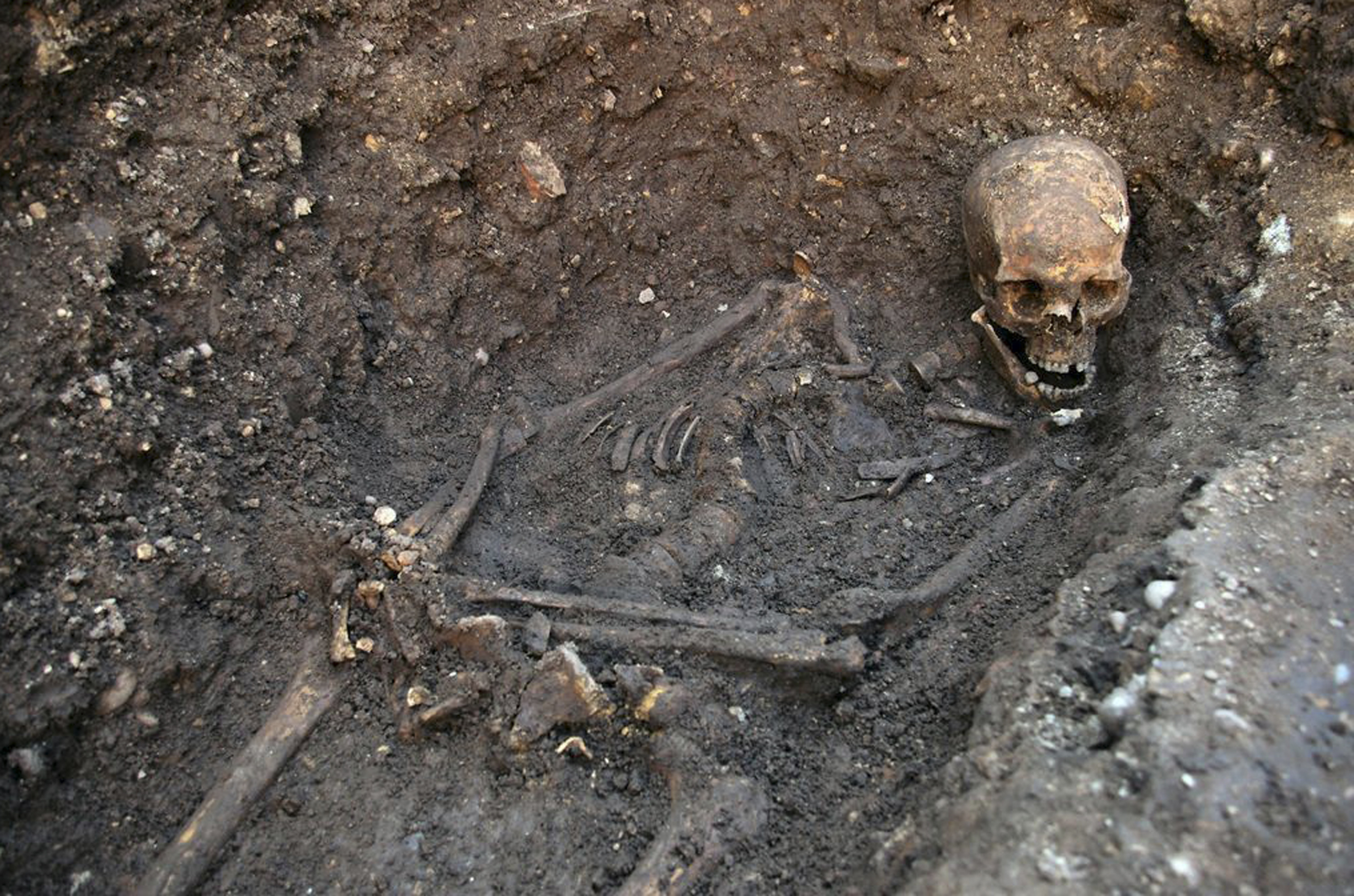 Study: King Richard III maligned as hunchback