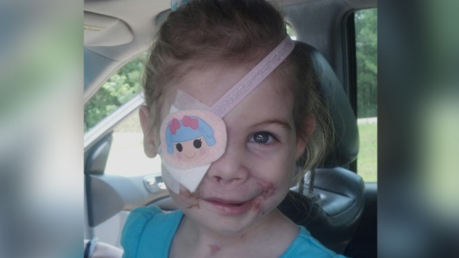 Surgeon offers to help girl mauled by pit bulls