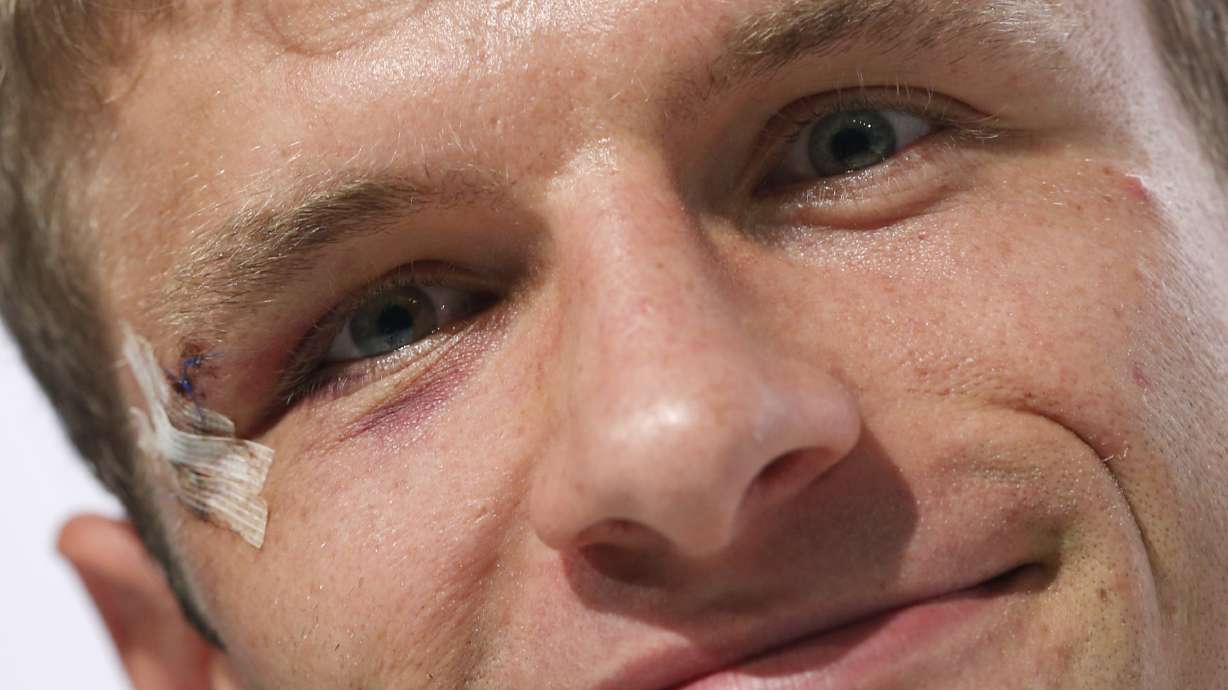A hat trick, then a bloody cut for Thomas Mueller