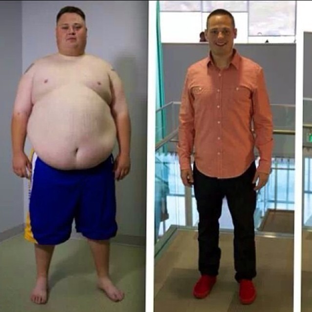 Provo Man Breaks Records On Abc S Extreme Weight Loss